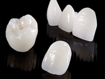 e-max、ジルコニア