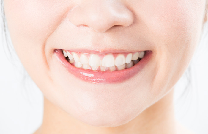 歯並びが悪いことによるデメリット