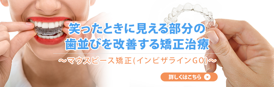 笑ったときに見える部分の歯並びを改善する矯正治療 ～マウスピース矯正(インビザラインGO)～